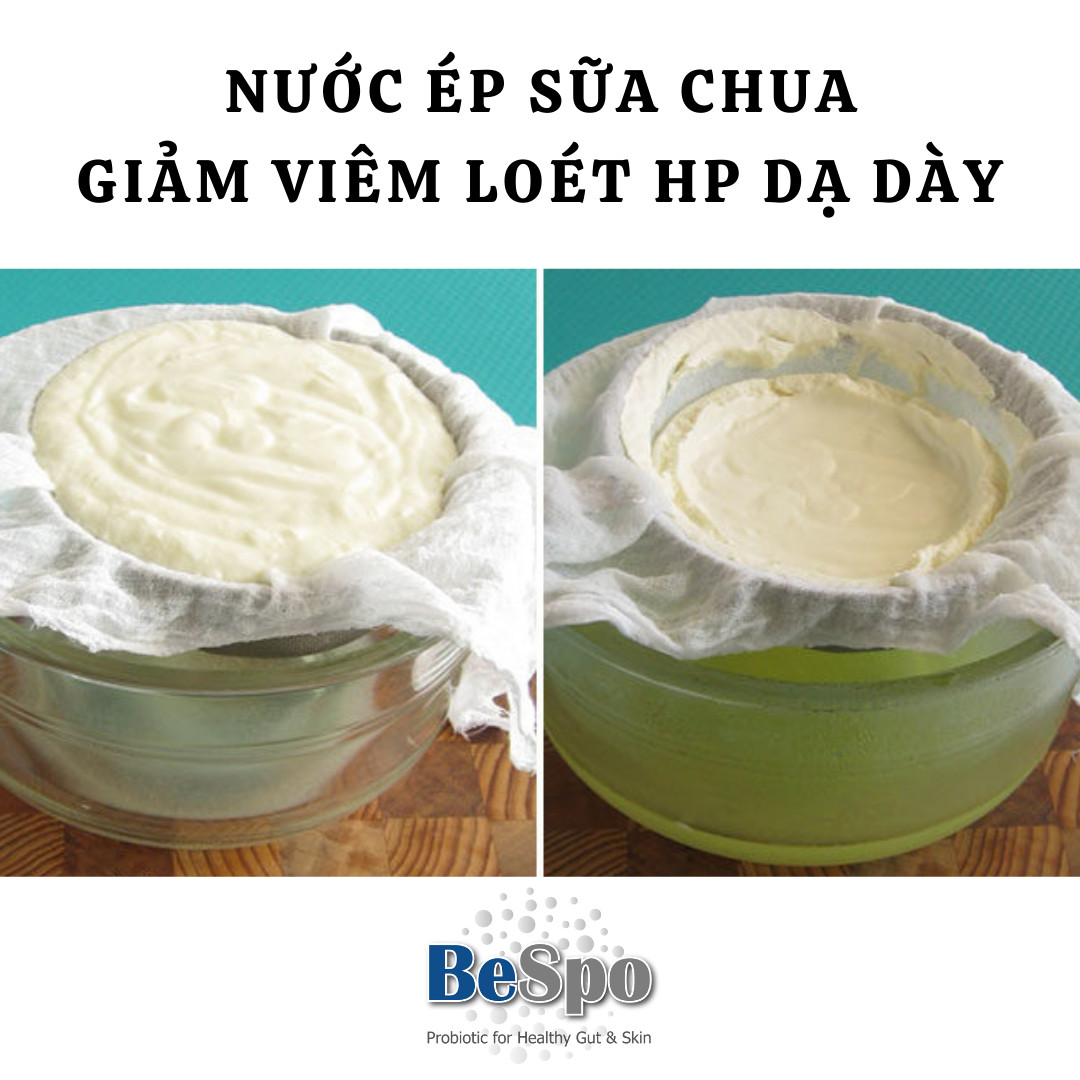 Nước ép sữa chua giảm viêm loét dạ dày do vi khuẩn HP